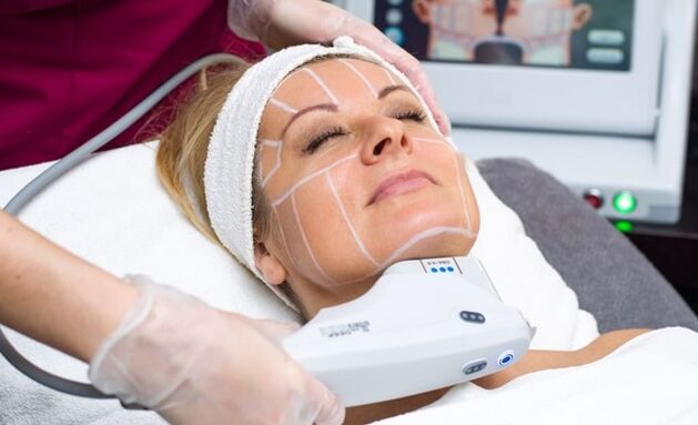Ultradźwiękowy lifting SMAS do niechirurgicznego liftingu twarzy