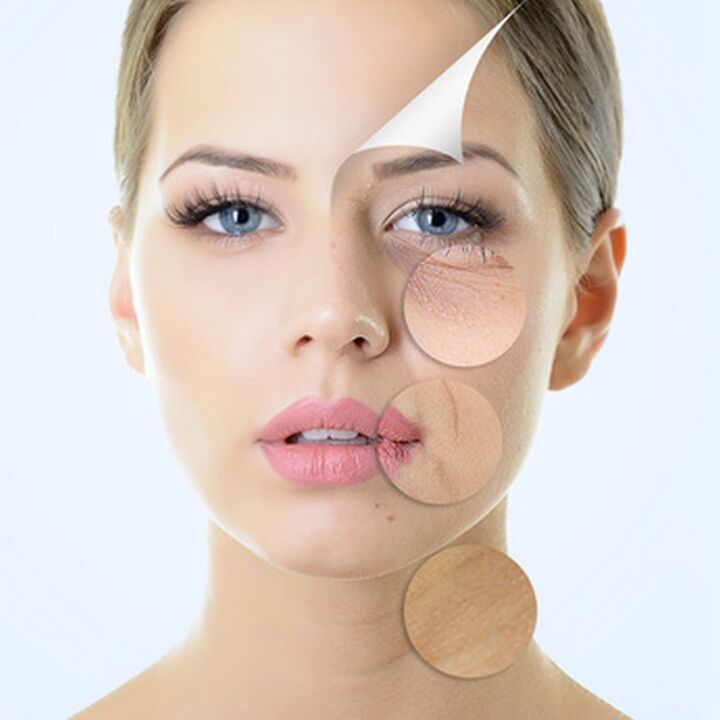Niedoskonałości skóry twarzy - wskazania do zabiegów przeciwstarzeniowych